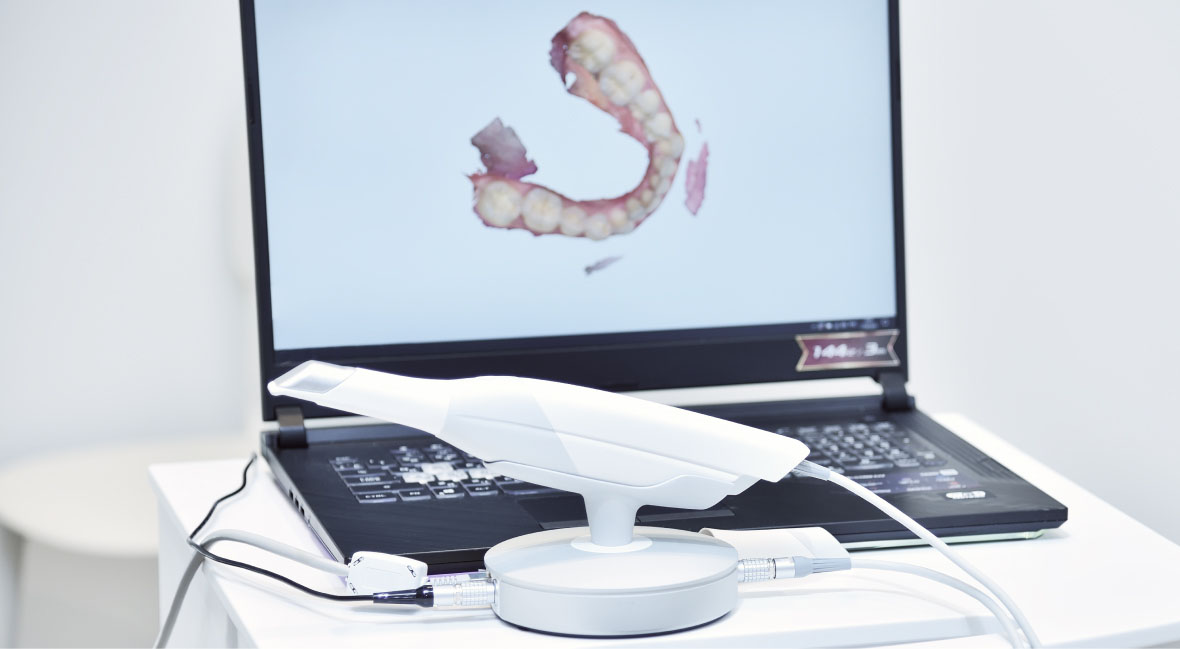 口腔内スキャナーとその結果を表示したノートPC画面の写真