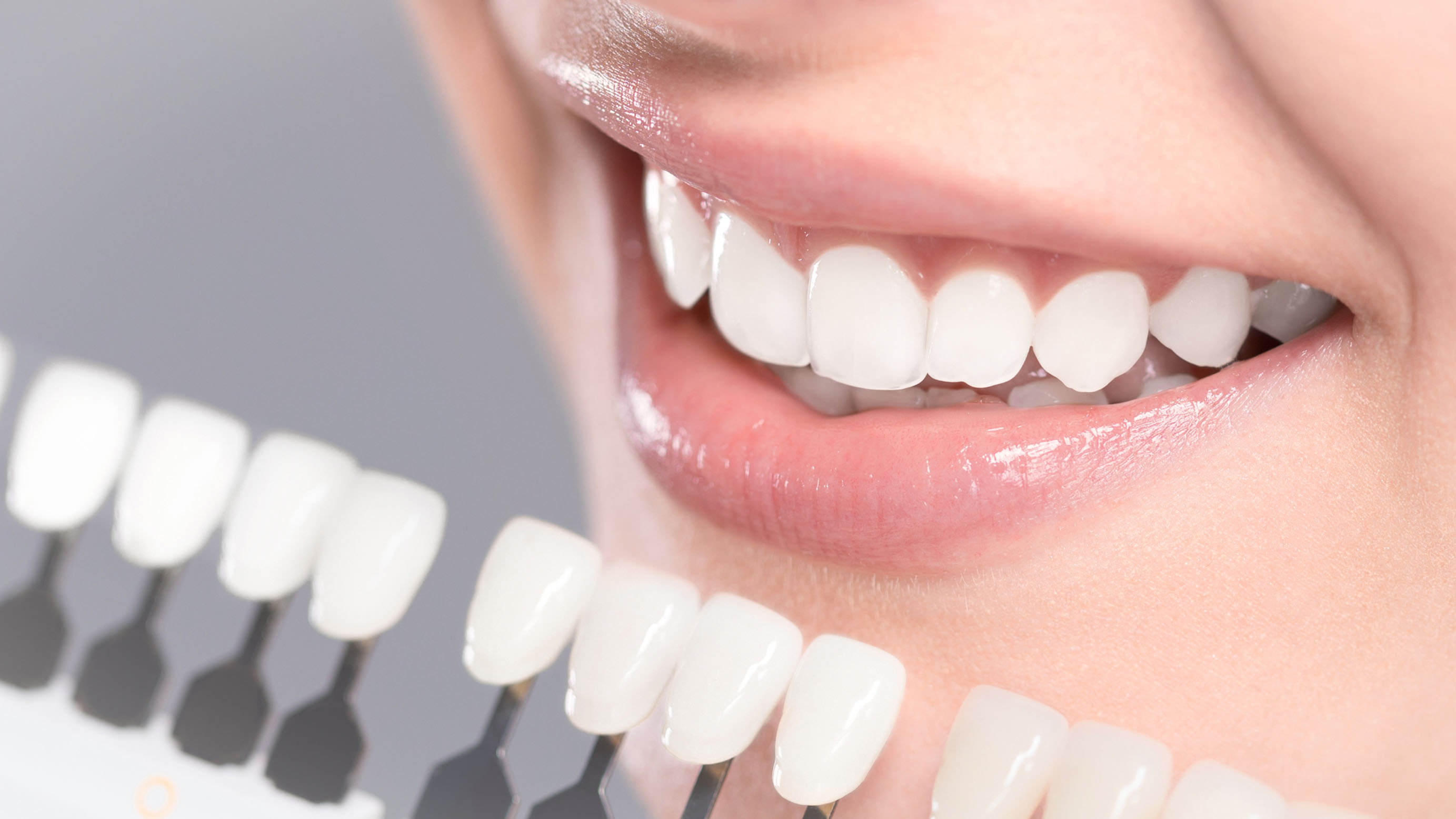 女性口元のきれいな歯と歯の白さの指標の写真