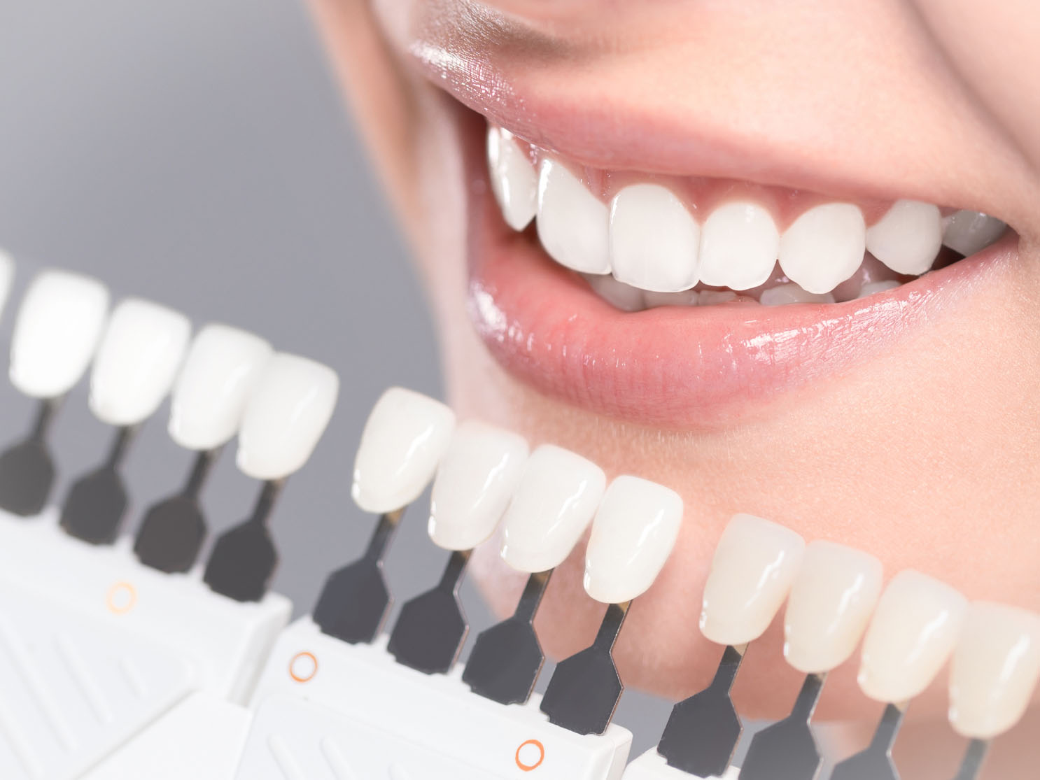 女性口元のきれいな歯と歯の白さの指標の写真