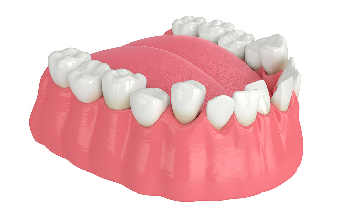 歯並びが悪い下顎の3D画像